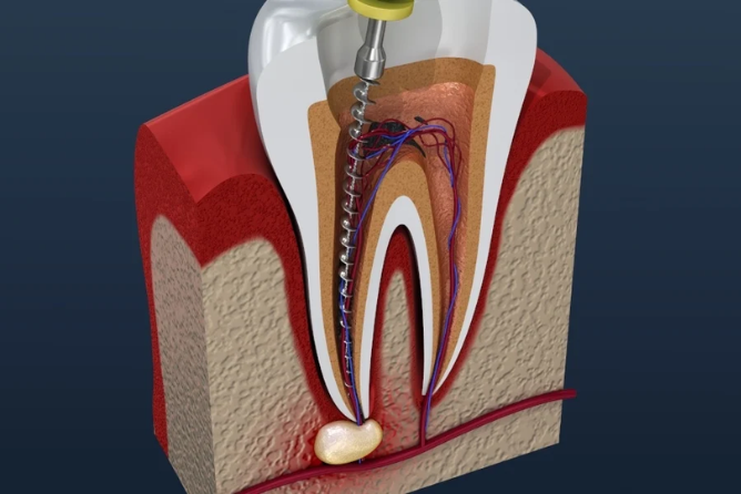 https://krishdentalstudio.com/wp-content/uploads/2025/04/krish-services-315-x-315-px-891-x-594-px.png